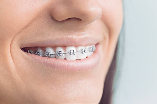 Professional Dental Services in Ballwin, MO